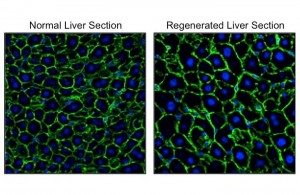Visualization of nuclei (blue) and outlines (green) of hepatocytes. Hepatocytes in the regenerated liver (right) were significantly larger than those in the normal liver (left). &copy; Yuichiro Miyaoka